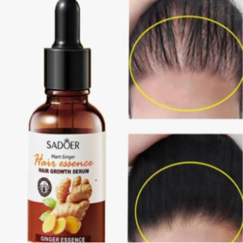 Serum De Jengibre Para Cabello Anticaida