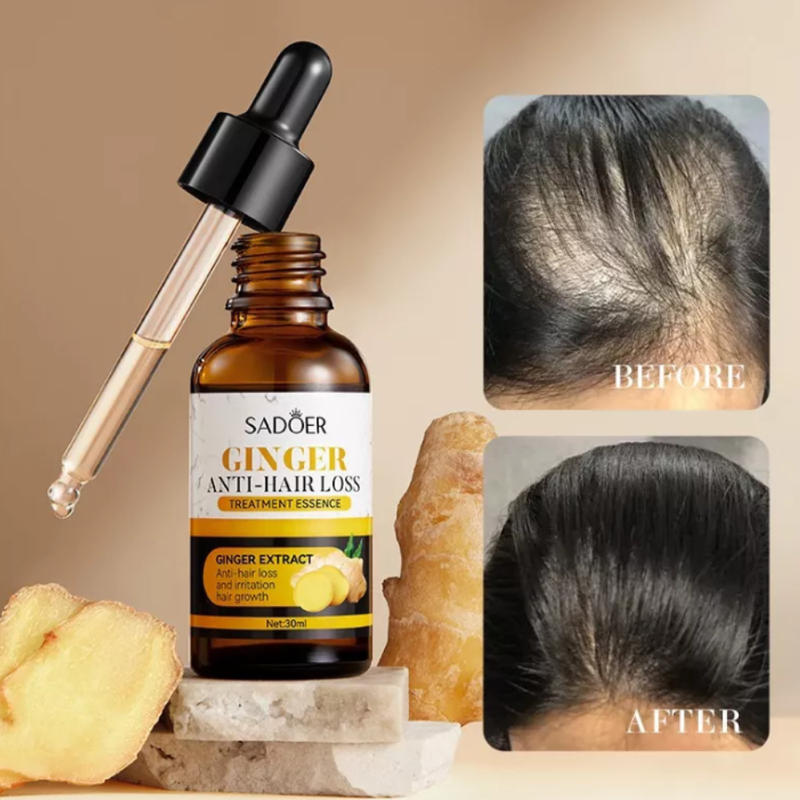 Serum De Jengibre Para Cabello Anticaida